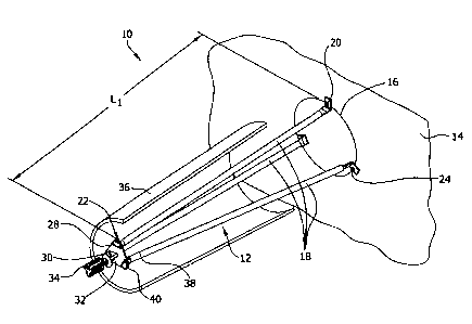 A single figure which represents the drawing illustrating the invention.